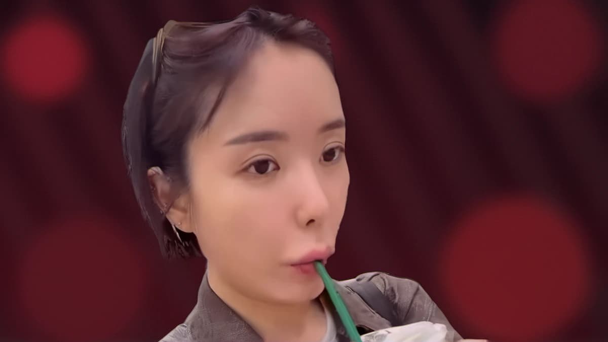 빨대 힘이 약해져도 계속…이소라가 ‘인중 보톡스’를 숨기지 않은 이유 — 제작 일러스트
